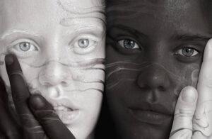 Albinism and The Eyes  