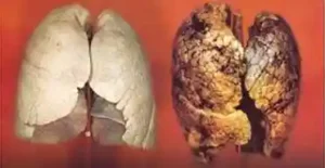 Smoking Effect on the Heart