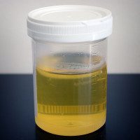 healthy urine color